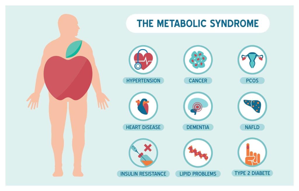Establishment and application of a new diagnostic definition of metabolic syndrome in the Shantou region of southern China | Scientific Reports – Nature