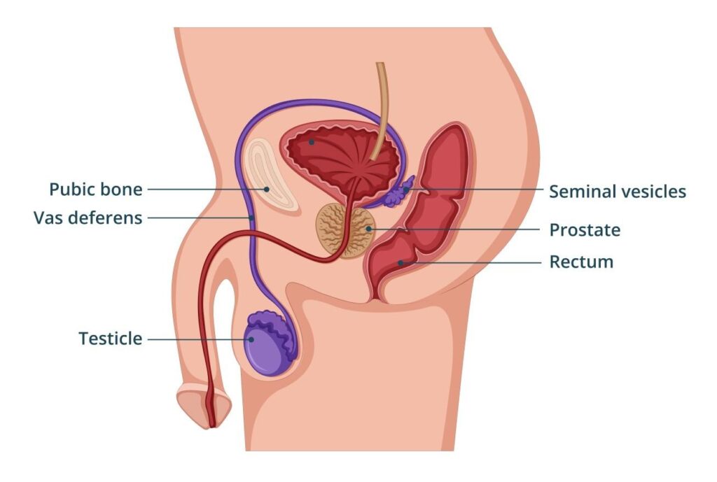 Group champions free prostate cancer screening in Lagos – The Guardian Nigeria News