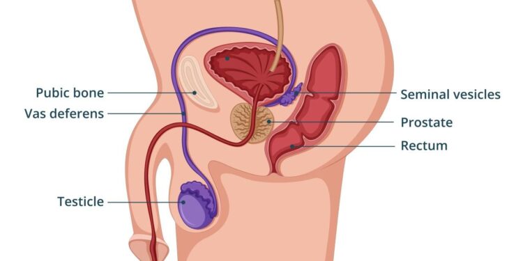 Group champions free prostate cancer screening in Lagos – The Guardian Nigeria News