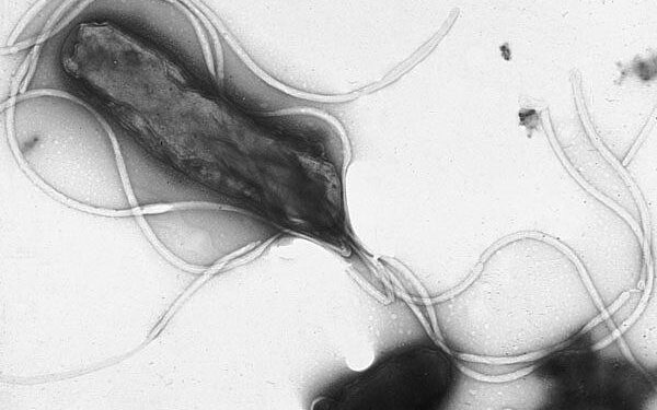 Antibiotic resistance of Helicobacter pylori isolated from patients in Nanjing, China: A cross-section study from 2018 to 2021 – Frontiers