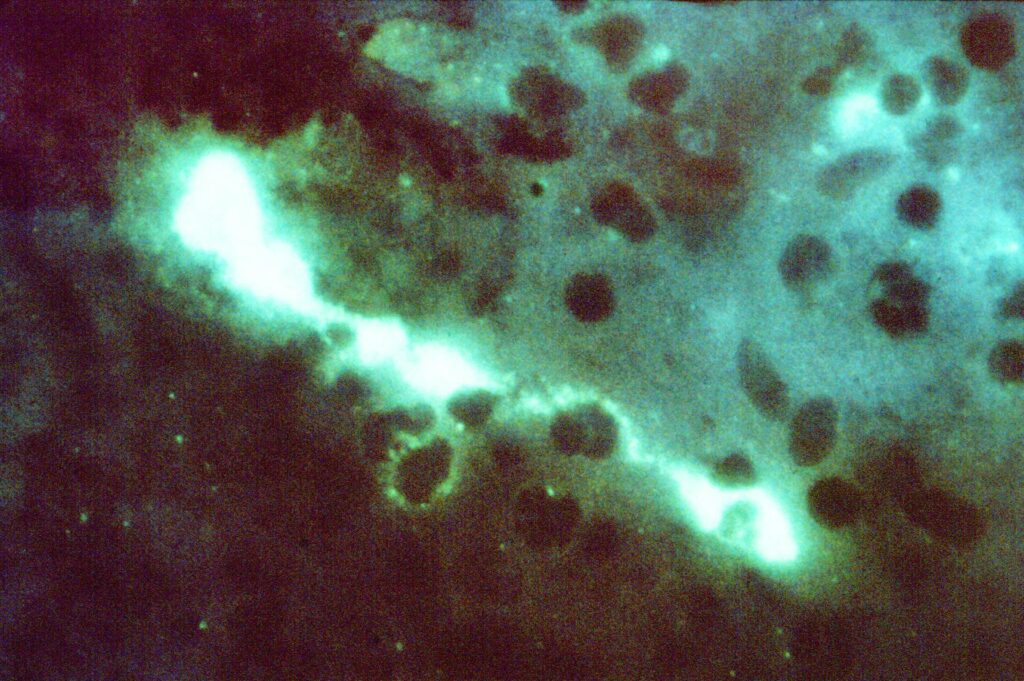Epidemiological characteristics of human psittacosis in Guangzhou, China, January 2021 to June 2024 – Frontiers