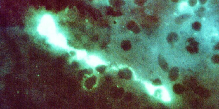 Epidemiological characteristics of human psittacosis in Guangzhou, China, January 2021 to June 2024 – Frontiers