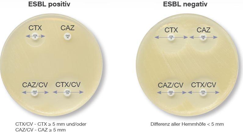 (PDF) Occurrence of extended-spectrum β-lactamase (ESBL) and carbapenemase-producing Escherichia coli isolated from childhood diarrhoea in Yaoundé, Cameroon – ResearchGate