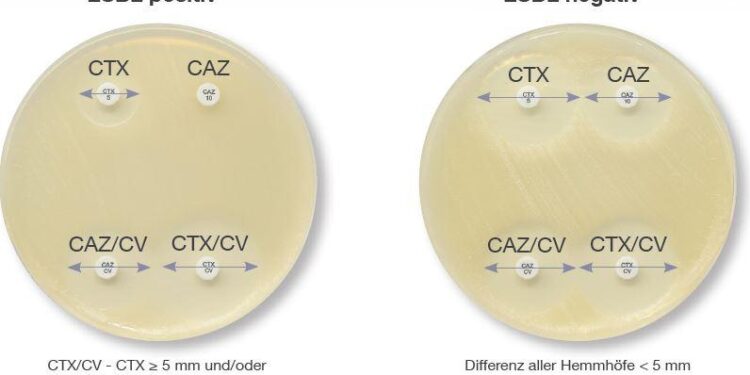(PDF) Occurrence of extended-spectrum β-lactamase (ESBL) and carbapenemase-producing Escherichia coli isolated from childhood diarrhoea in Yaoundé, Cameroon – ResearchGate