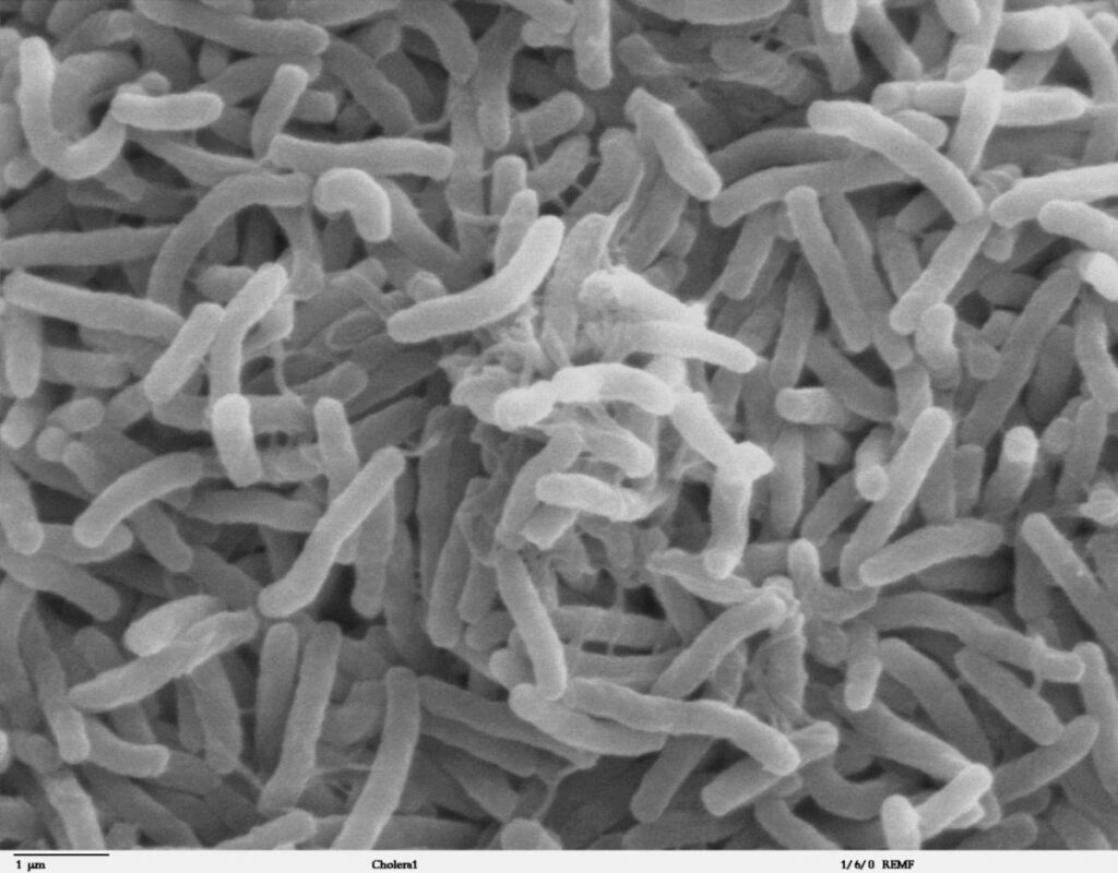 Cholera spike in Sudan strains resources 5 known dead in plant explosion in China Zimbabwe radio tax on drivers irks some Hong Kong reveals names of twin pandas – The Arkansas Democrat-Gazette