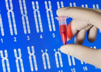 Nigerians must take genotype tests seriously to reduce sickle cell cases – Akinsete – The Guardian Nigeria News