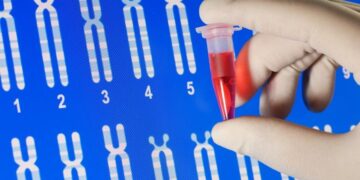 Nigerians must take genotype tests seriously to reduce sickle cell cases – Akinsete – The Guardian Nigeria News