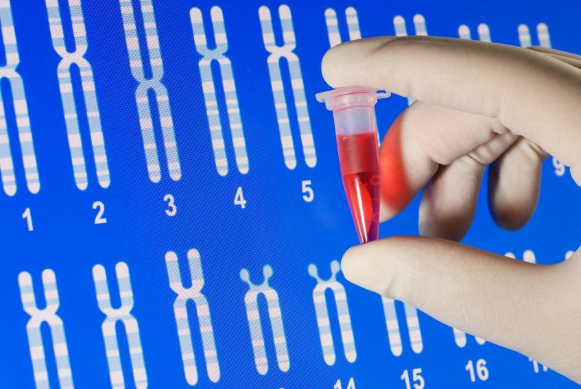 Nigerians must take genotype tests seriously to reduce sickle cell cases – Akinsete – The Guardian Nigeria News