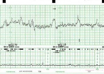Ctg awaits a sea of change – The Financial Express