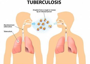 Analysis of the epidemiological characteristics of pulmonary tuberculosis in Shijiazhuang, China 2010-2023 – Frontiers