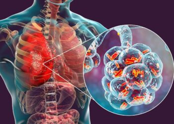 Australia health emergency: Legionnaires’ disease outbreak in Sydney’s Potts Point, 3 hospitalised; sympto – The Economic Times