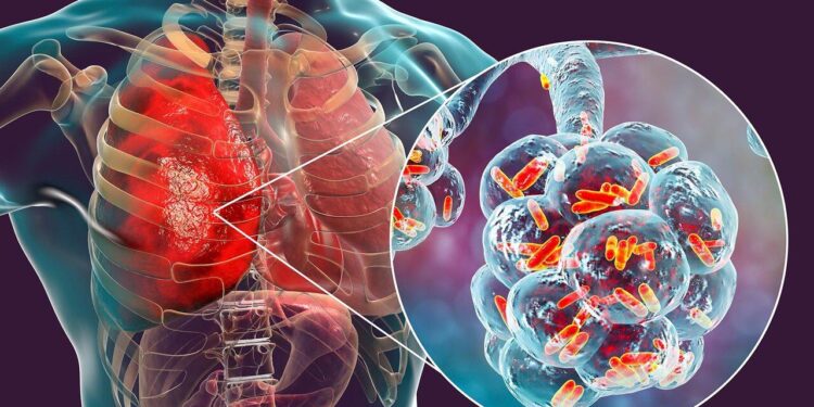 Australia health emergency: Legionnaires’ disease outbreak in Sydney’s Potts Point, 3 hospitalised; sympto – The Economic Times