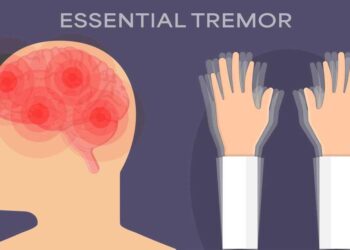 Tremor leaves at least one deat in Lima, Peru – MercoPress