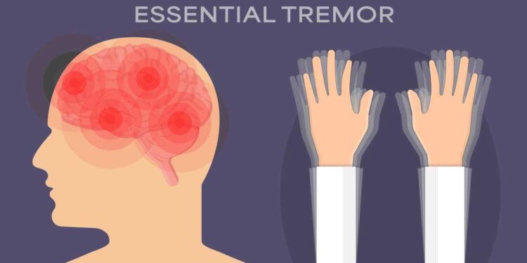 Tremor leaves at least one deat in Lima, Peru – MercoPress