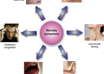 Allergic rhinitis in college students at Dongguan: a cross-sectional survey on disease burden, knowledge, and self-management – Frontiers