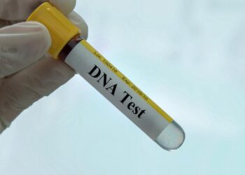 DNA Test Identifies Last Victim Of Ahmedabad Crash, Death Count Stands At 260 – NDTV