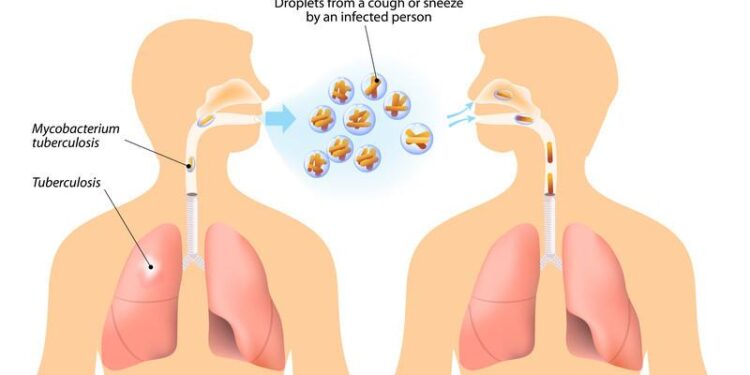 Geodemographic analysis of socioeconomic area disparities in tuberculosis incidence in Osaka City, Japan – Nature