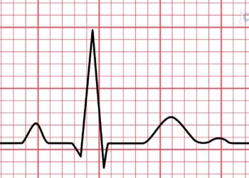 ECG announces scheduled power outages in parts of Greater Accra Region on July 21 – GhanaWeb