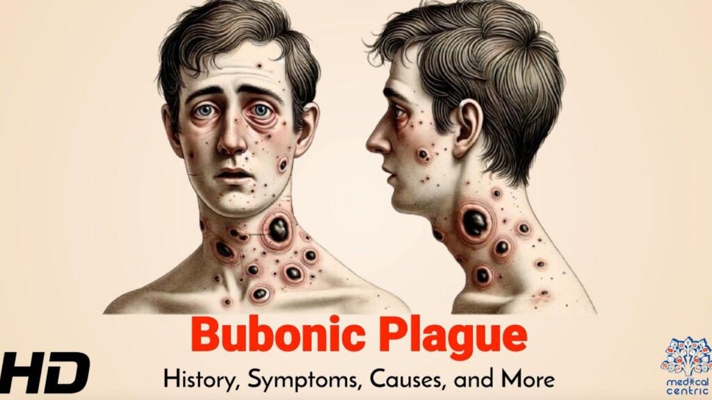 A plague mysteriously spread from Europe into Asia 4,000 years ago. Scientists now think they may know how – CNN