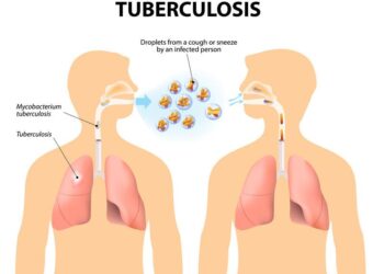 Experts review Myanmar’s progress and challenges in the fight against tuberculosis and recommend future directions – World Health Organization (WHO)