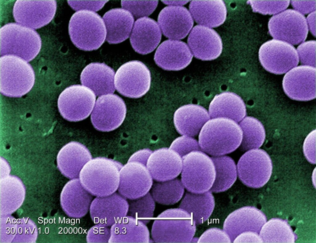 Molecular Characteristics of Staphylococcus aureus From Food Samples and Food Poisoning Outbreaks in Shijiazhuang, China – Frontiers