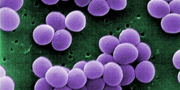 Molecular Characteristics of Staphylococcus aureus From Food Samples and Food Poisoning Outbreaks in Shijiazhuang, China – Frontiers