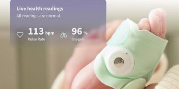 Owlet expands medically-certified baby monitor to South Africa – Investing.com