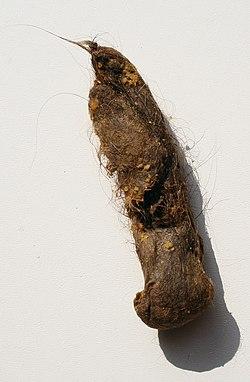 ‘World’s longest’ hairball removed from teen’s gut at Jaipur hospital – Times of India