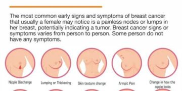 Twenty years of breast cancer epidemiology and treatment patterns in São Paulo, Brazil—observed versus expected treatment utilization in a retrospective cohort – The Lancet