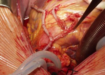 Bypass sees highest residential rent growth in Kolkata; Joka leads in price appreciation – Times of India