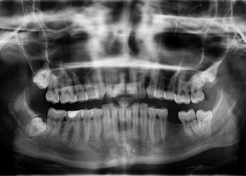 Max Verstappen had X-ray on hands after Melbourne F1 qualifying crash – Motorsport.com