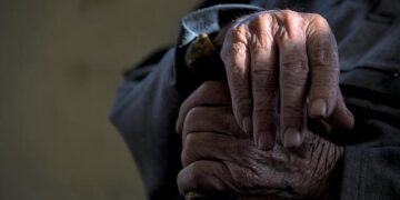 Risk factors associated with higher skin age relative to chronological age in community-dwelling middle-aged Japanese adults | Scientific Reports – Nature